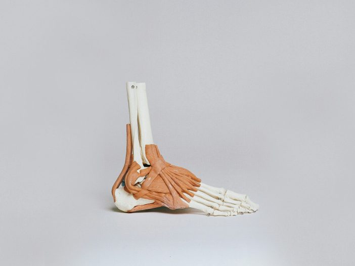 model of a foot showing the ligaments and the plantar fascia