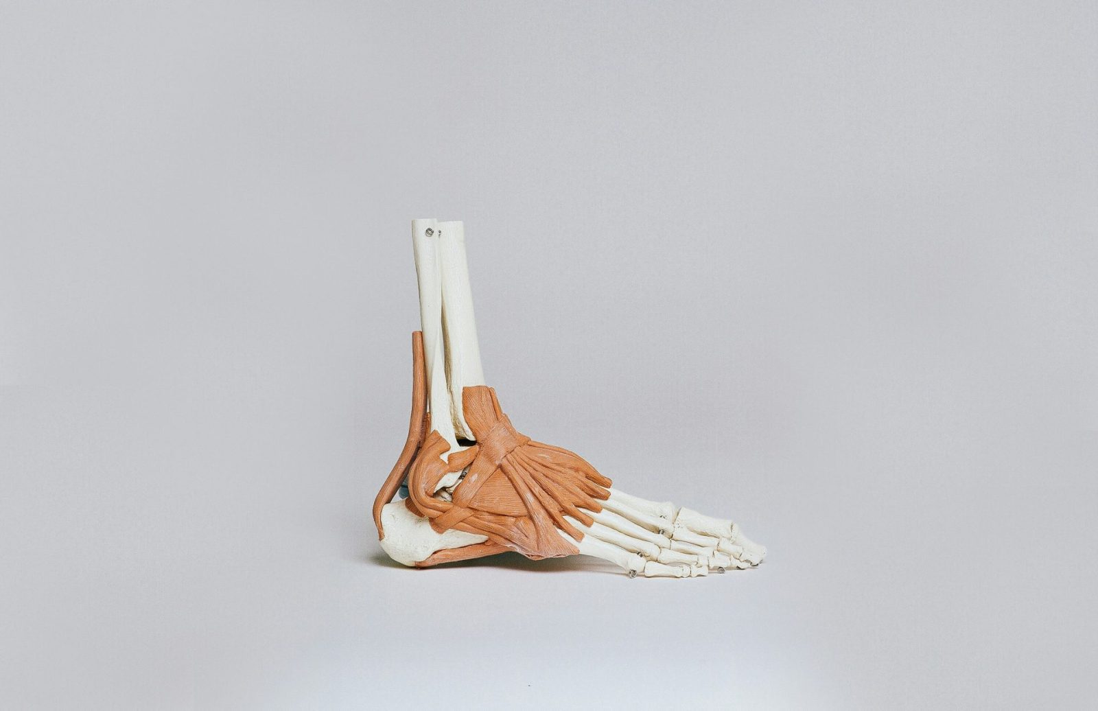 model of a foot showing the ligaments and the plantar fascia