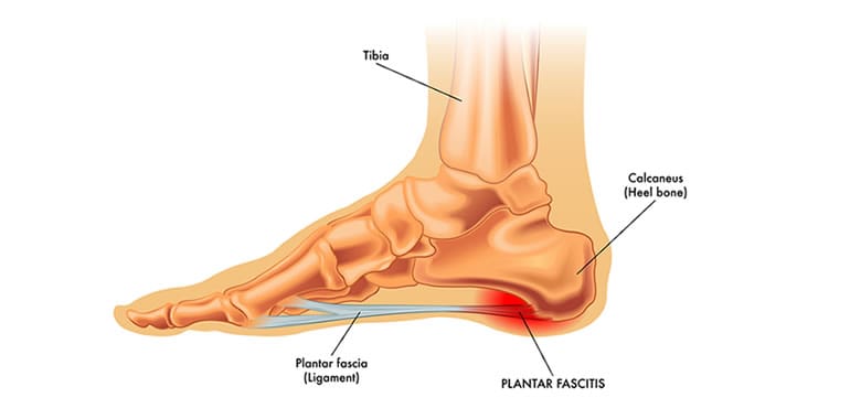 a diagram showing the bones and ligaments in the feet