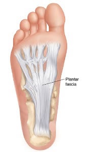 diagram showing the plantar fascia ligament in the foot