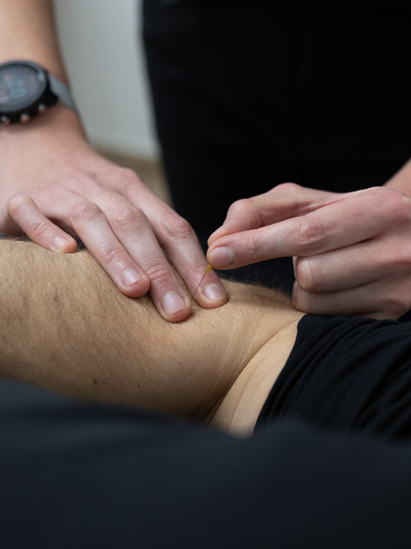 Elbow pain physical therapy dry needling