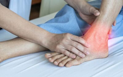 Physical therapy after a car Accident – Treating Foot Injuries