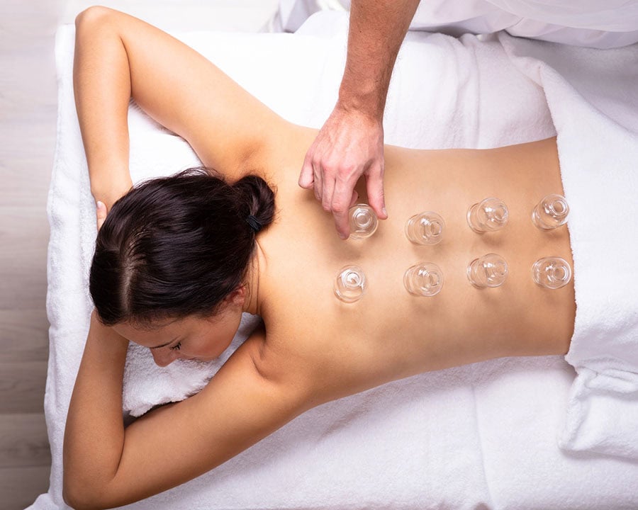 lady receiving cupping therapy on her back