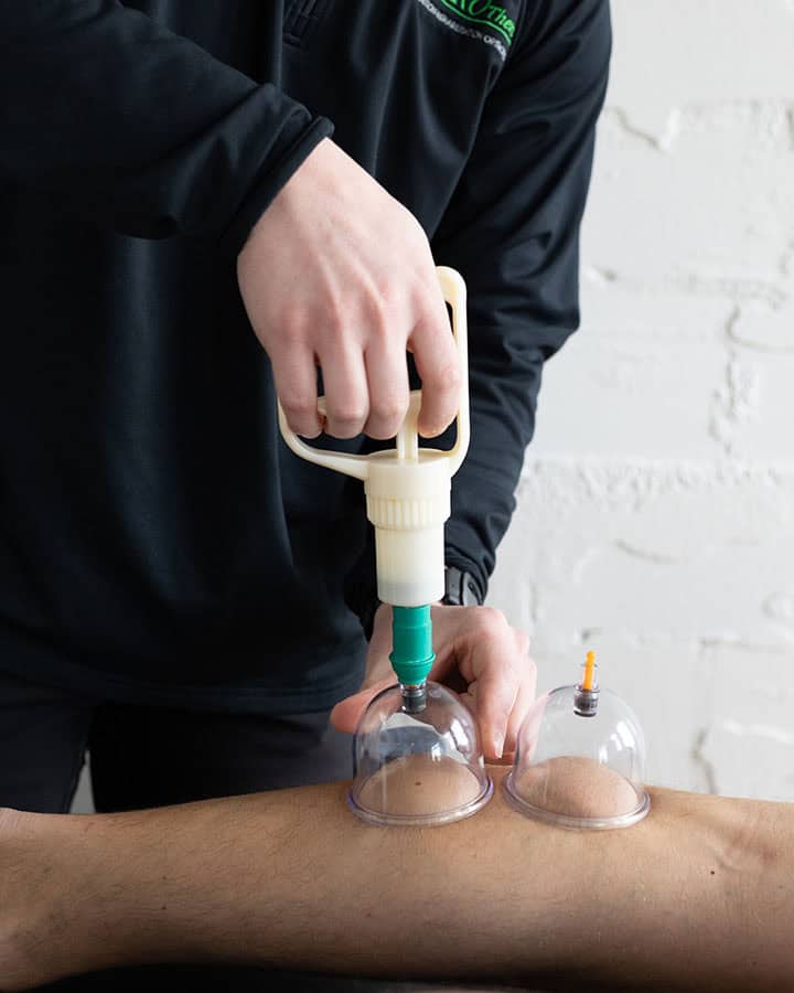 pro-therapy-stemwave-machine cupping cups on the back of the leg