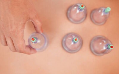 The Athlete’s Guide to Cupping Therapy for Faster Recovery and Pain Relief